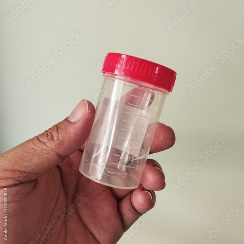 Title: A person with dark skin holds a small, clear, plastic specimen collection cup with a red screw cap, typically used for medical urine or stool sample testing.