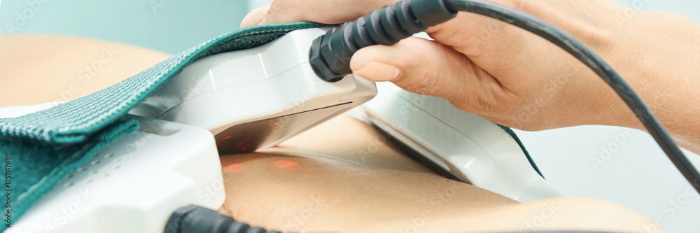 Fototapeta premium Close-up of hand operating laser lipo device on abdomen for non-invasive fat reduction procedure.