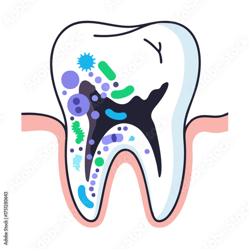 A stylized cartoon molar tooth cross-section showing a large black cavity filled with colorful, stylized bacteria, illustrating advanced dental decay.