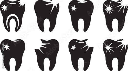 Tooth decay set vector illustration for dental health awareness campaign