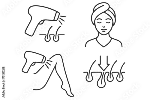 Female hair removal process: laser treatment steps and benefits illustrated