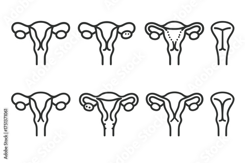 Illustration of common uterine anomalies and variations in outline style