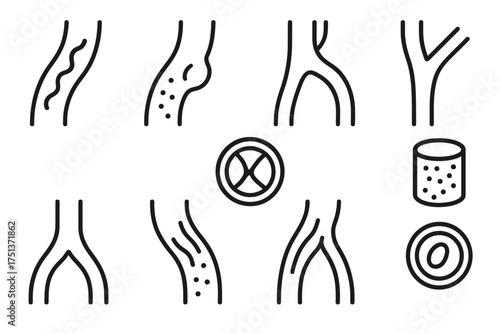Simple line art illustrations of arteries: blockage, healthy, cross-sections, stenosis
