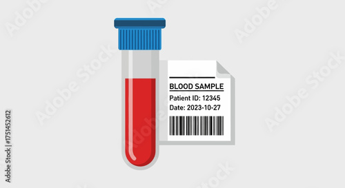 Medical blood sample collection in a laboratory test tube, crucial for diagnostics, health monitoring, and patient information