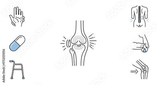 Joint pain, arthritis icon set. Rheumatoid, osteoarthritis symptoms. Orthopedics, rheumatology concepts. Knee, hand, back, elbow inflammation. Medical treatment icons.