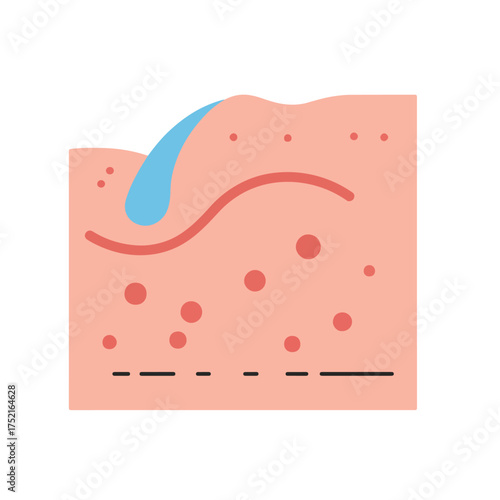 Acne Concerns: Exploring Causes and Effective Skincare Solutions