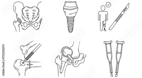 Medical illustration of hip joint surgery and recovery isolated on transparent background
