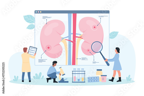 Kidney disease, nephrology vector illustration. Cartoon tiny doctors study science infographic diagram of human kidney with magnifying glass, nephrologists research patients physiology and symptoms