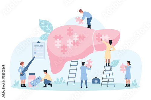 Liver disease diagnosis and treatment, hepatology vector illustration. Cartoon tiny people holding pieces of puzzle jigsaw to fit into big human organ, diagnostic examination by hepatologists