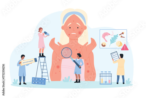 Diagnosis of allergy at examination with allergist vector illustration. Cartoon tiny people with magnifying glass research allergic symptoms on skin of woman, doctors advise antihistamine treatment