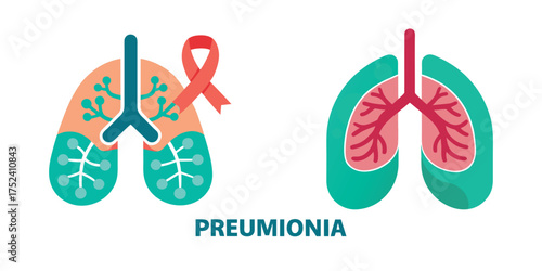 Pneumonia Lungs Disease Illustration Isolated on White Background