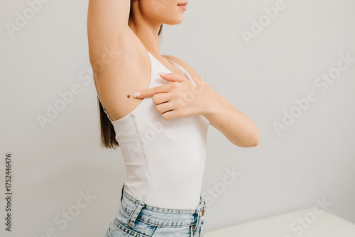 Examination of skin neoplasm and lesions of young woman. Dermatologist examines moles or birthmark of girl patient for revention of melanoma and skin cancer close-up. Checking for benign moles.