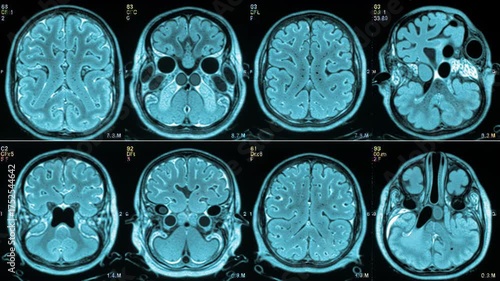 Wallpaper Mural Brain Scan Medical Imaging Neurology Blue Hue on Black Backdrop Torontodigital.ca
