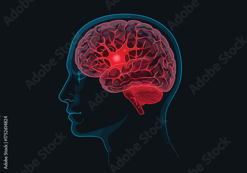 Illustration of a human head profile with a highlighted brain, indicating a neurological condition or focus area.