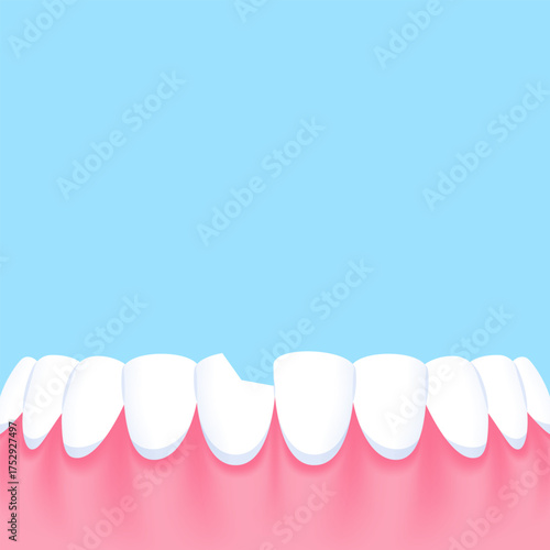 Lower teeth (Chipped) - Text box sign blank banner (square) illustration vector design. Dental care concept.