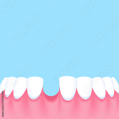 Lower teeth (Missing tooth) - Text box sign blank banner (square) illustration vector design. Dental care concept.