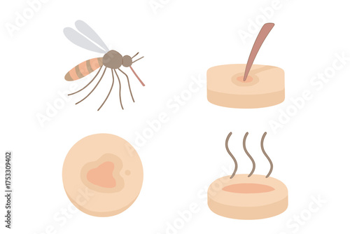 Mosquito Bite Illustration. Isometric vector illustration set mosquito proboscis bite itch: insect hovering mid-air, extended