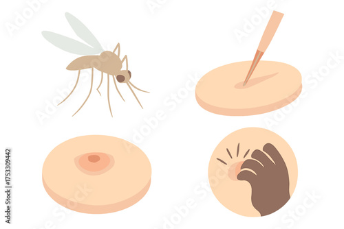 Mosquito Bite Illustration. Isometric vector illustration set mosquito proboscis bite itch: insect hovering mid-air, extended