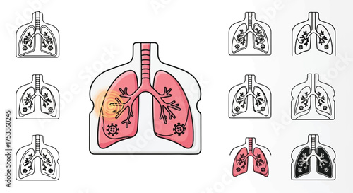 Illustration of healthy and unhealthy lungs with bronchi and bronchioles in various conditions on a white background.