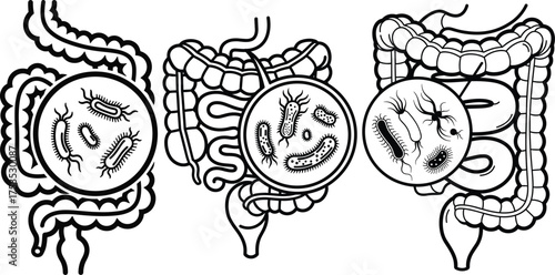 Magnified circular inserts showcase various bacteria germs and microbes of human intestines