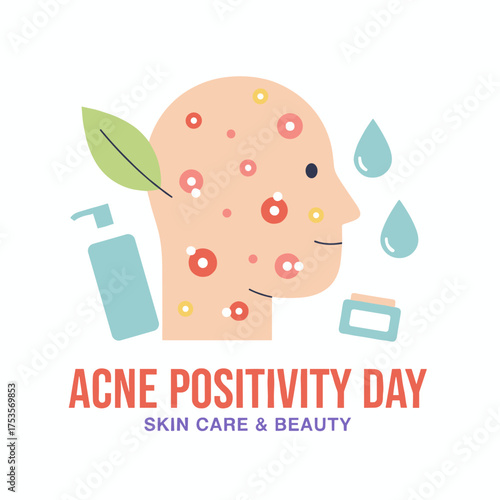 Acne therapy, Acne Positivity Day, skincare, beauty concept, acne complexion, dermal dermatology, pimple skin