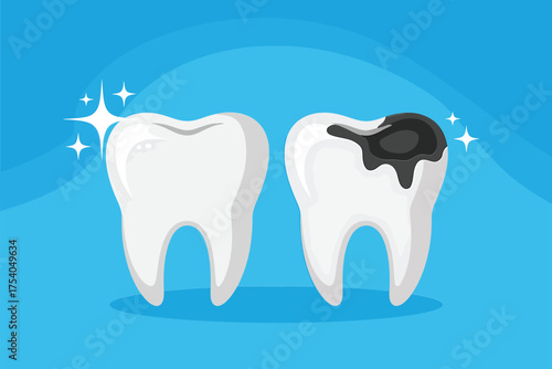 Illustration of healthy tooth and tooth decay isolated on blue background concept of dental care, oral hygiene, and prevention of cavities on transparent background