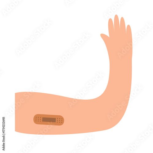 Implant contraception concept. vector illustration