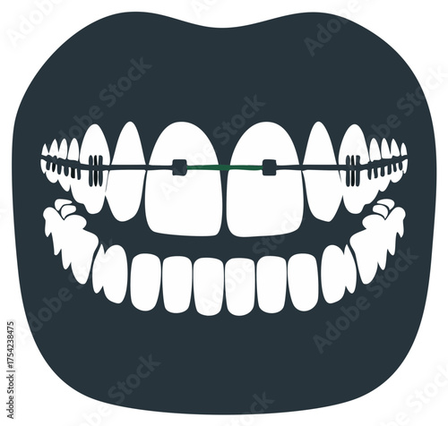 Stylized illustration of human teeth with dental braces showing orthodontic alignment.