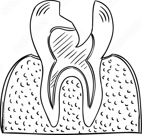 vector illustration of a broken tooth. damaged tooth icon. 