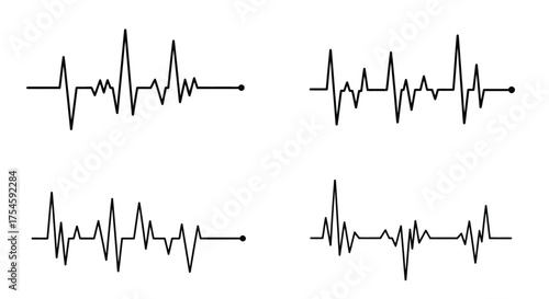 Four electrocardiogram waveforms displayed on a clean white background