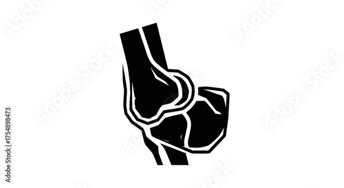 Detailed illustration of a human knee joint in black and white.