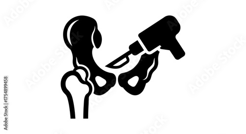 Medical icon of orthopedic hip surgery procedure.