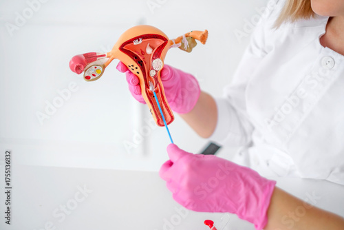 A model of the female reproductive organ. Taking a smear for analysis from the cervical canal. Diagnosis of diseases in gynecology