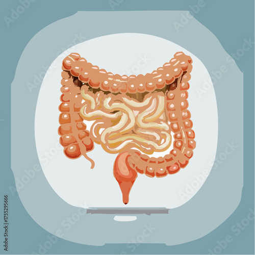 Anatomical illustration of the human large and small intestines for medical education.