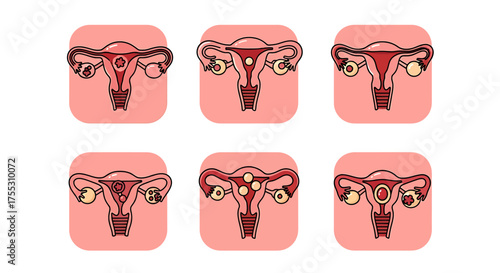 Six stylized illustrations depicting different conditions of the female reproductive system.