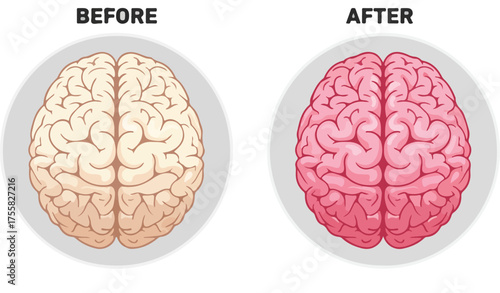 Comparing brain activity before and after stimulation neural enhancement