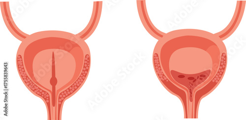 Human Urinary Bladder Vector Illustration - Anatomy and Medical Diagram-urinary bladder-urology symbol-internal organs vector