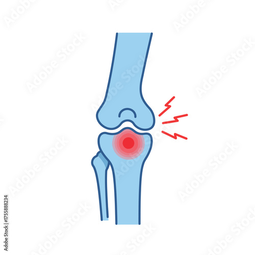 An illustrative medical diagram showing a human knee joint experiencing significant pain and inflammation, highlighting common orthopedic issues and discomfort.