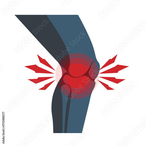 An illustrative depiction of a human knee experiencing acute pain and inflammation, highlighted by radiating red circles, representing joint discomfort or injury.