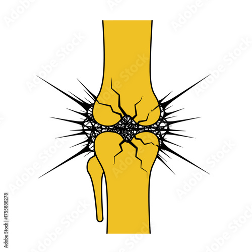 A powerful graphic depicting a human knee joint with severe cracks and radiating spikes, symbolizing intense orthopedic pain, injury, and chronic discomfort.