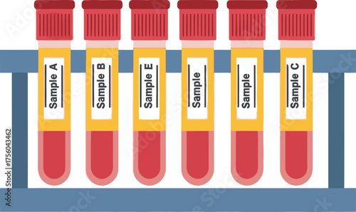 Six labeled blood samples in test tubes, placed in a blue rack.