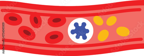 of a blood vessel with red and white blood cells & platelets.
