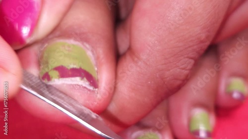 Wallpaper Mural An Asian Indian girls leg with dirty nails are shown in a close-up view as she trims her fingernails at home using a nail clipper Torontodigital.ca