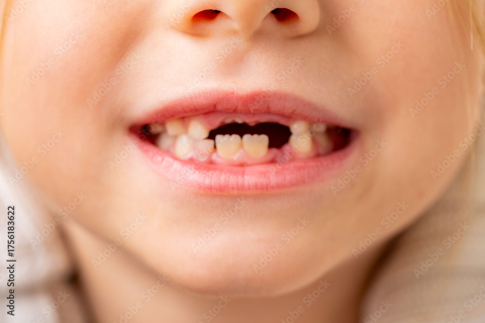 Naklejka premium happy positive caucasian funny toothless 6-year-old girl, child baby tooth, smiling childhood moment waiting for toothfairy, growing up, cute Toothless smile expression, innocence and joy childhood