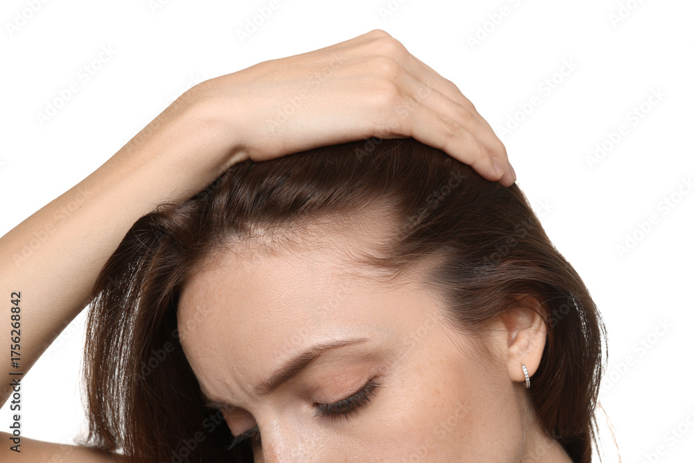 Naklejka premium Woman with hair loss problem on white background, closeup