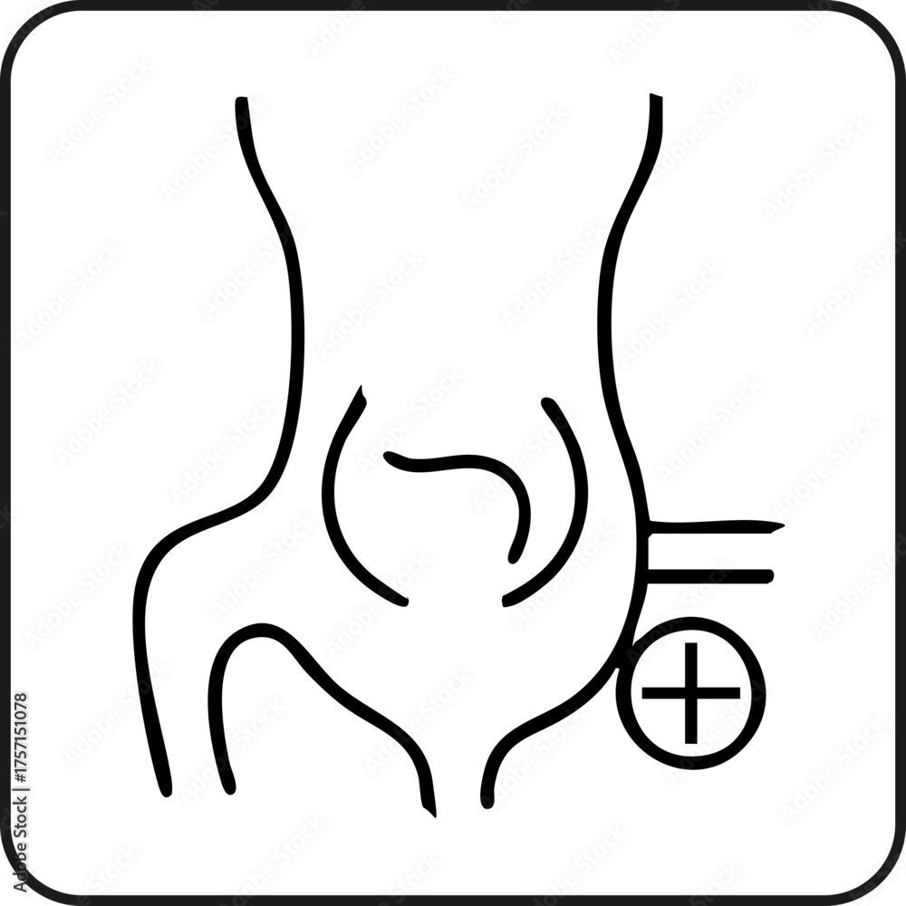 Obraz premium Hernia Repair