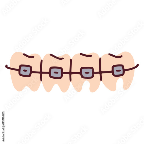 A close-up view of a row of teeth fitted with metal orthodontic braces. This image represents the process of teeth straightening and bite correction to achieve a healthy and perfectly aligned smile.