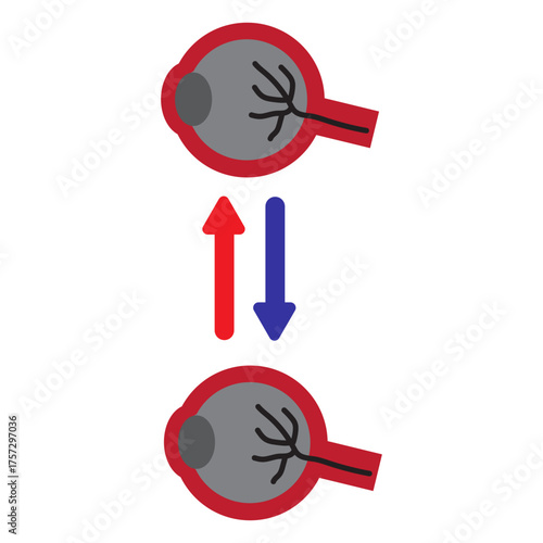 Eye Transplant