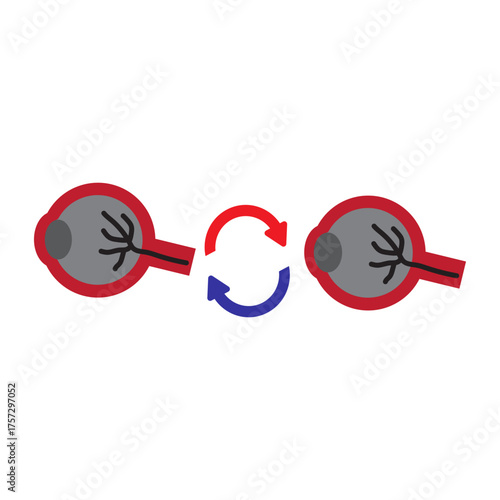 Eye Transplant