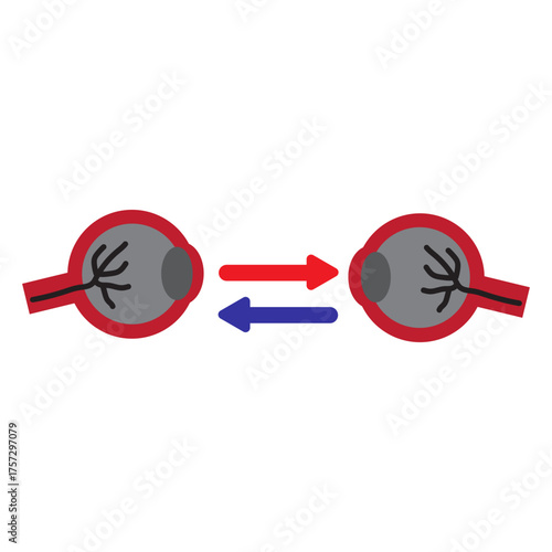 Eye Transplant